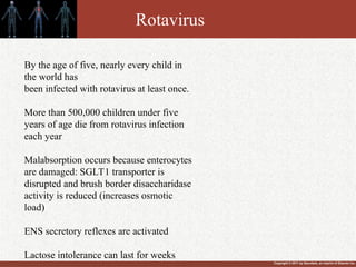 Copyright © 2011 by Saunders, an imprint of Elsevier Inc.
Rotavirus
By the age of five, nearly every child in
the world has
been infected with rotavirus at least once.
More than 500,000 children under five
years of age die from rotavirus infection
each year
Malabsorption occurs because enterocytes
are damaged: SGLT1 transporter is
disrupted and brush border disaccharidase
activity is reduced (increases osmotic
load)
ENS secretory reflexes are activated
Lactose intolerance can last for weeks
 