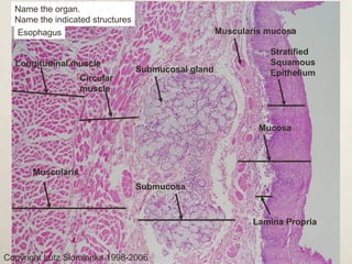 Name the organ. 
Name the indicated structures 
Esophagus 
Longitudinal muscle 
Copyright Lutz Slomianka 1998-2006 
Muscularis mucosa 
Stratified 
Squamous 
Epithelium 
Mucosa 
Submucosal gland 
Circular 
muscle 
Submucosa 
Lamina Propria 
Muscularis 
 