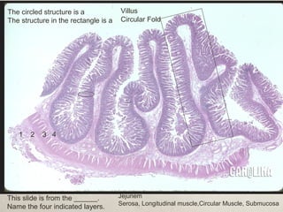 1 2 3 4 
This slide is from the ______. 
Name the four indicated layers. 
Jejunem 
Serosa, Longitudinal muscle,Circular Muscle, Submucosa 
The circled structure is a 
The structure in the rectangle is a 
Villus 
Circular Fold 
 