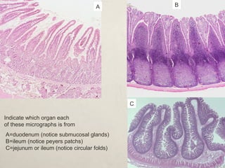 Indicate which organ each 
of these micrographs is from 
A B 
C 
A=duodenum (notice submucosal glands) 
B=ileum (notice peyers patchs) 
C=jejunum or ileum (notice circular folds) 
 