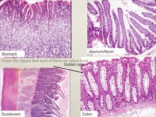 Stomach Jejunum/ileum 
Name the organs that each of these are taken from 
Goblet cells 
Name the indicated cells 
Duodonem Colon 
 