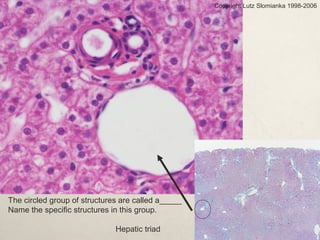 Copyright Lutz Slomianka 1998-2006 
The circled group of structures are called a_____ 
Name the specific structures in this group. 
Hepatic triad 
 