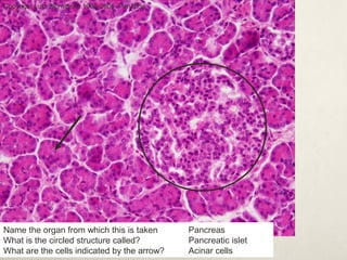 Copyright Lutz Slomianka 1998-2006 Pan20he 
Name the organ from which this is taken 
What is the circled structure called? 
What are the cells indicated by the arrow? 
Pancreas 
Pancreatic islet 
Acinar cells 
 