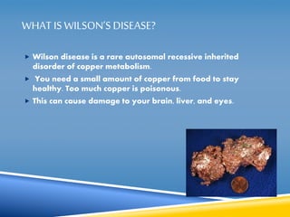 WHAT IS WILSON’S DISEASE? 
 Wilson disease is a rare autosomal recessive inherited 
disorder of copper metabolism. 
 You need a small amount of copper from food to stay 
healthy. Too much copper is poisonous. 
 This can cause damage to your brain, liver, and eyes. 
 