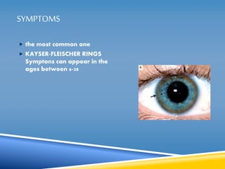 SYMPTOMS 
 the most common one 
 KAYSER-FLEISCHER RINGS 
Symptons can appear in the 
ages between 6-38 
 