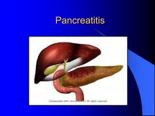 Pancreatitis
 