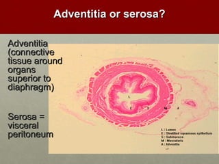 AAddvveennttiittiiaa oorr sseerroossaa?? 
AAddvveennttiittiiaa 
((ccoonnnneeccttiivvee 
ttiissssuuee aarroouunndd 
oorrggaannss 
ssuuppeerriioorr ttoo 
ddiiaapphhrraaggmm)) 
SSeerroossaa == 
vviisscceerraall 
ppeerriittoonneeuumm 
 