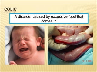A disorder caused by excessive food that
comes in
 