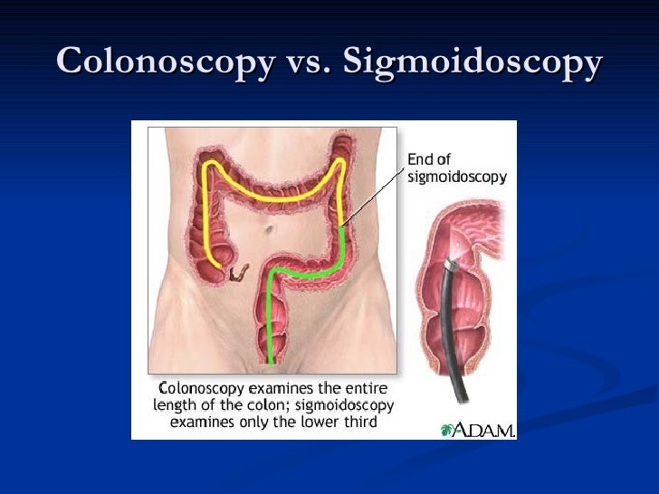 colonoscopy hematochezia cachexia anastomosis