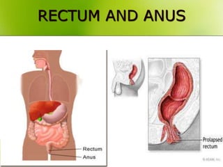 RECTUM AND ANUS
 