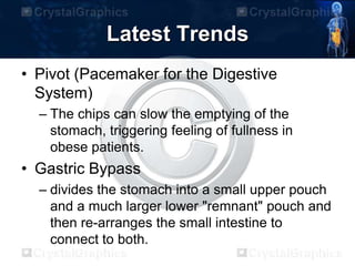 Latest Trends
• Pivot (Pacemaker for the Digestive
System)
– The chips can slow the emptying of the
stomach, triggering feeling of fullness in
obese patients.
• Gastric Bypass
– divides the stomach into a small upper pouch
and a much larger lower "remnant" pouch and
then re-arranges the small intestine to
connect to both.
 