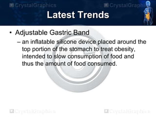 Latest Trends
• Adjustable Gastric Band
– an inflatable silicone device placed around the
top portion of the stomach to treat obesity,
intended to slow consumption of food and
thus the amount of food consumed.
 