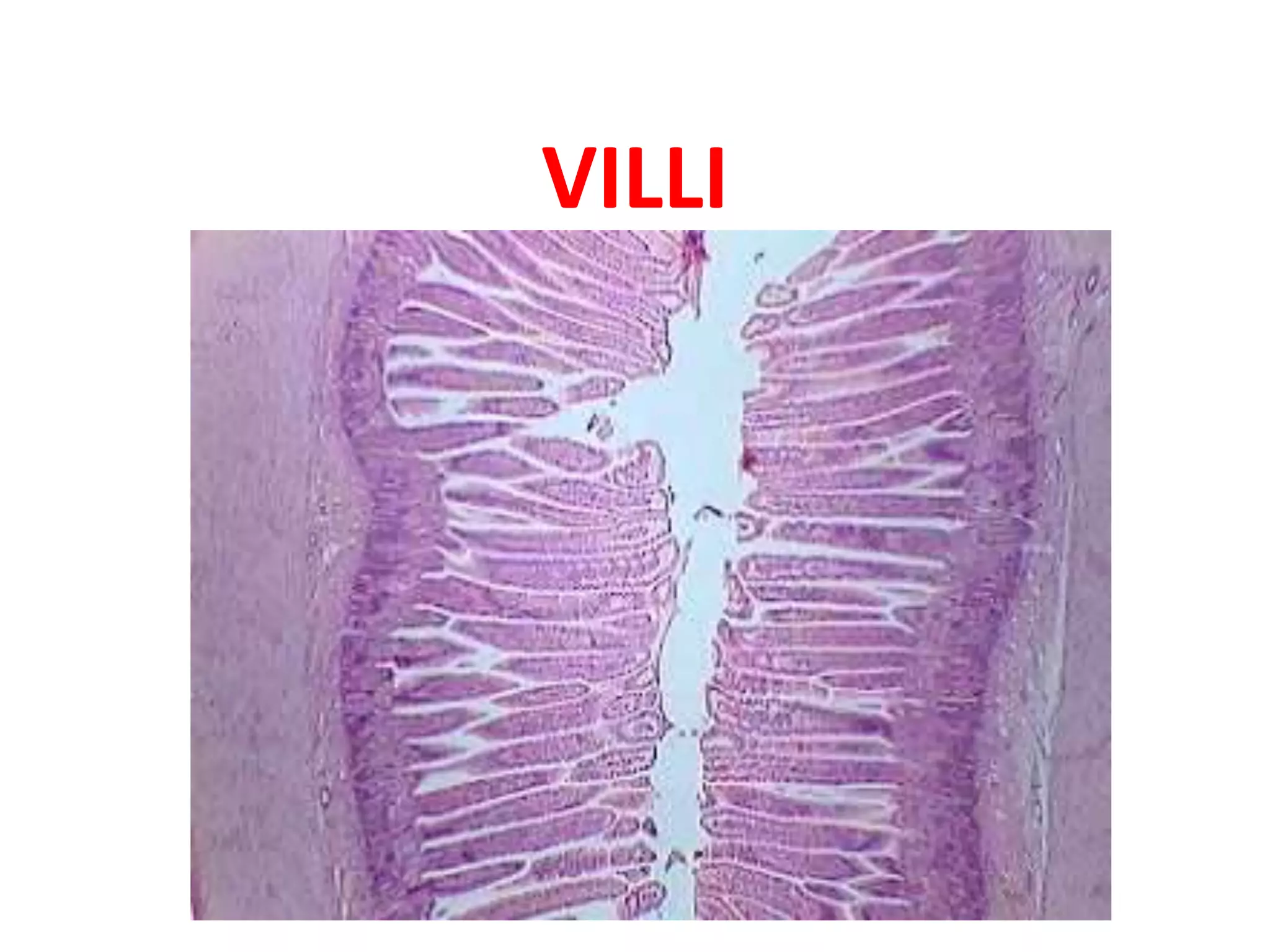 VILLI
 