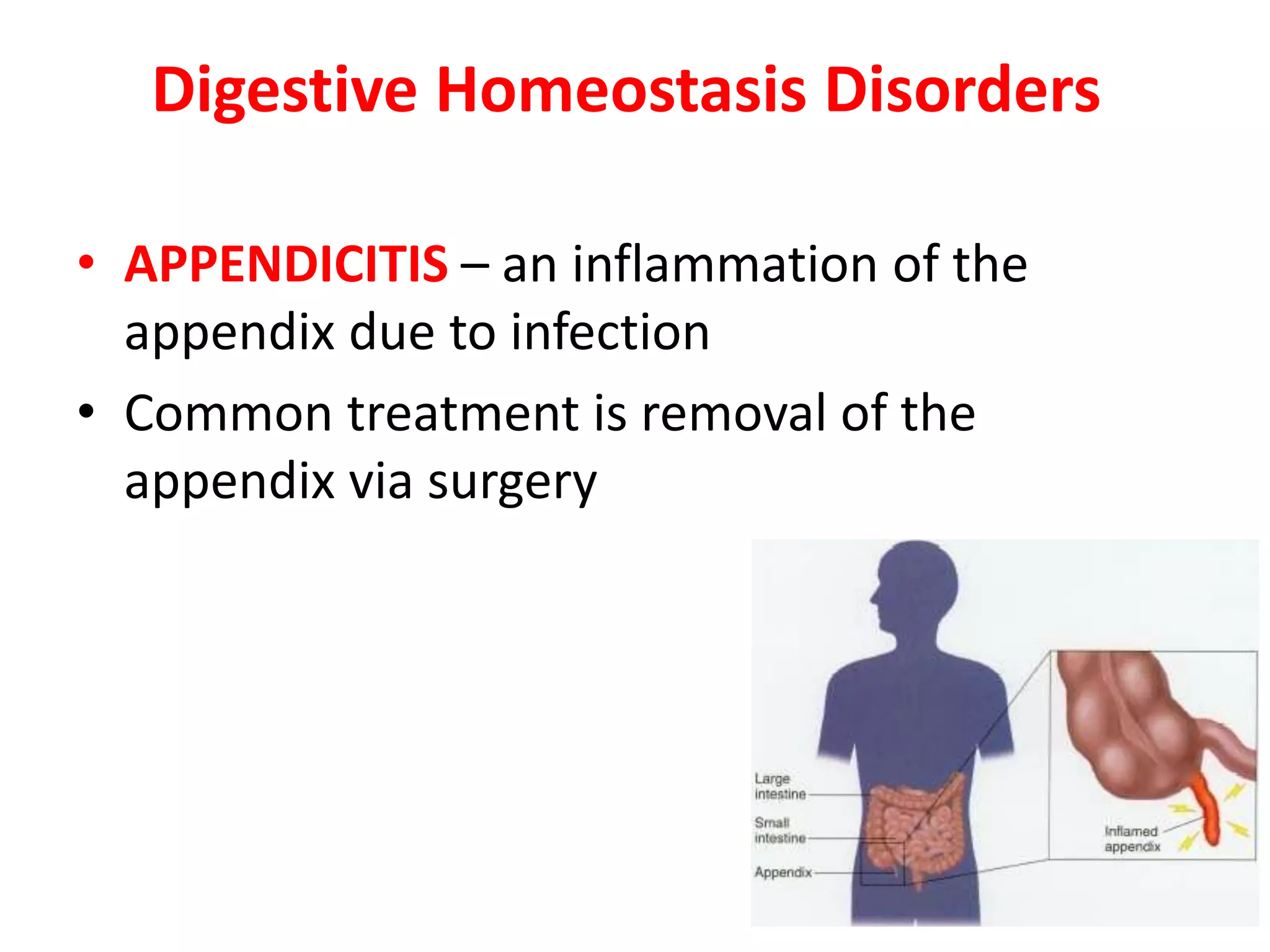 Digestive Homeostasis Disorders
• APPENDICITIS – an inflammation of the
appendix due to infection
• Common treatment is removal of the
appendix via surgery
 