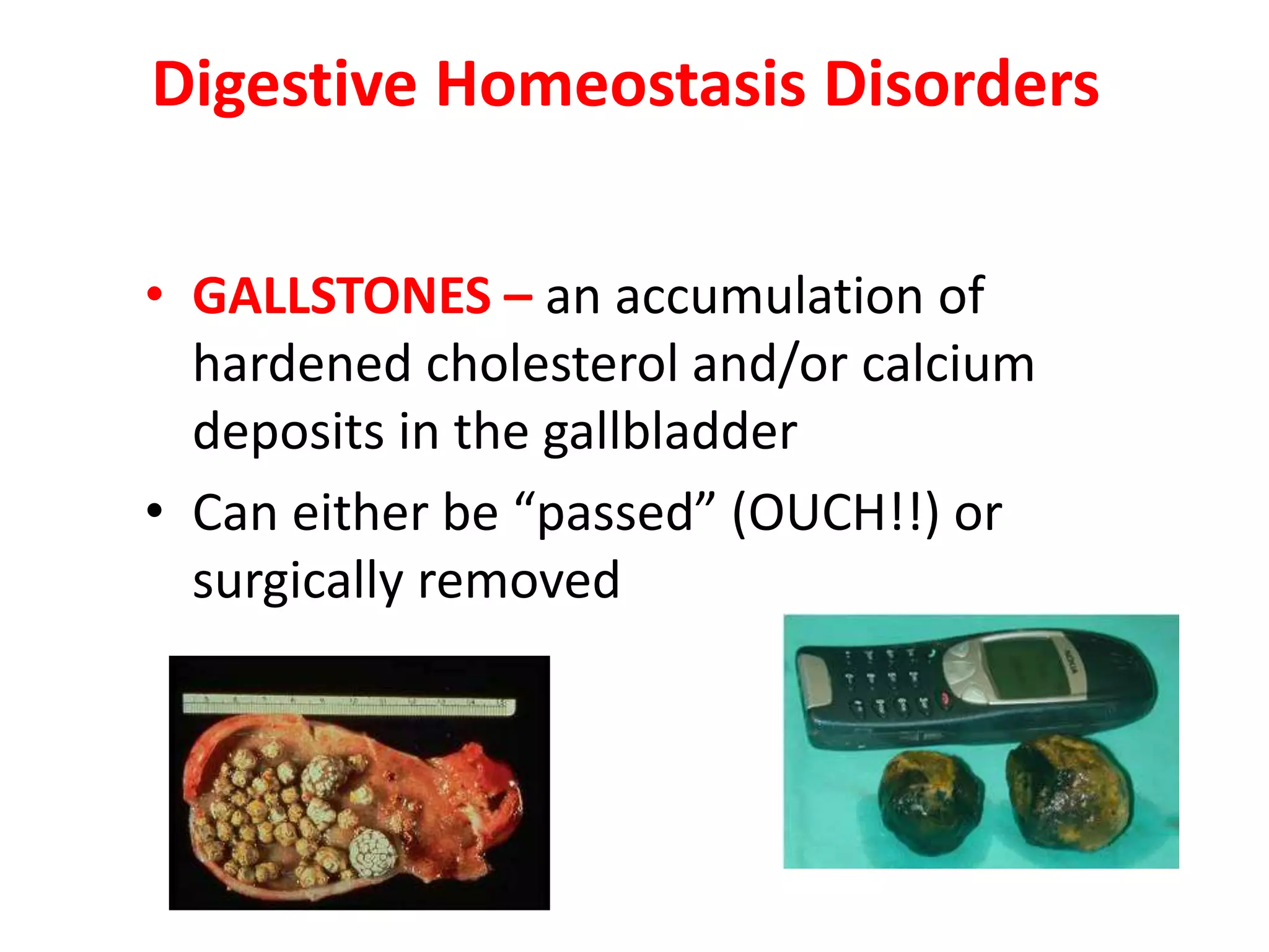 Digestive Homeostasis Disorders
• GALLSTONES – an accumulation of
hardened cholesterol and/or calcium
deposits in the gallbladder
• Can either be “passed” (OUCH!!) or
surgically removed
 