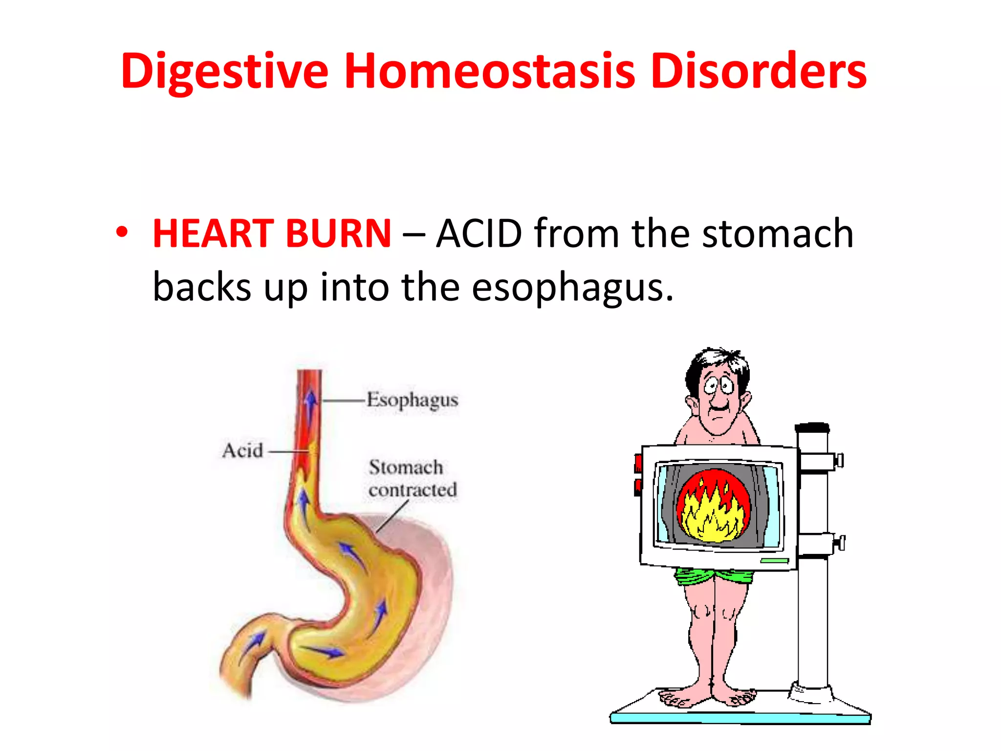 Digestive Homeostasis Disorders
• HEART BURN – ACID from the stomach
backs up into the esophagus.
 