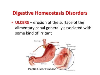 Digestive Homeostasis Disorders
• ULCERS – erosion of the surface of the
alimentary canal generally associated with
some kind of irritant
 