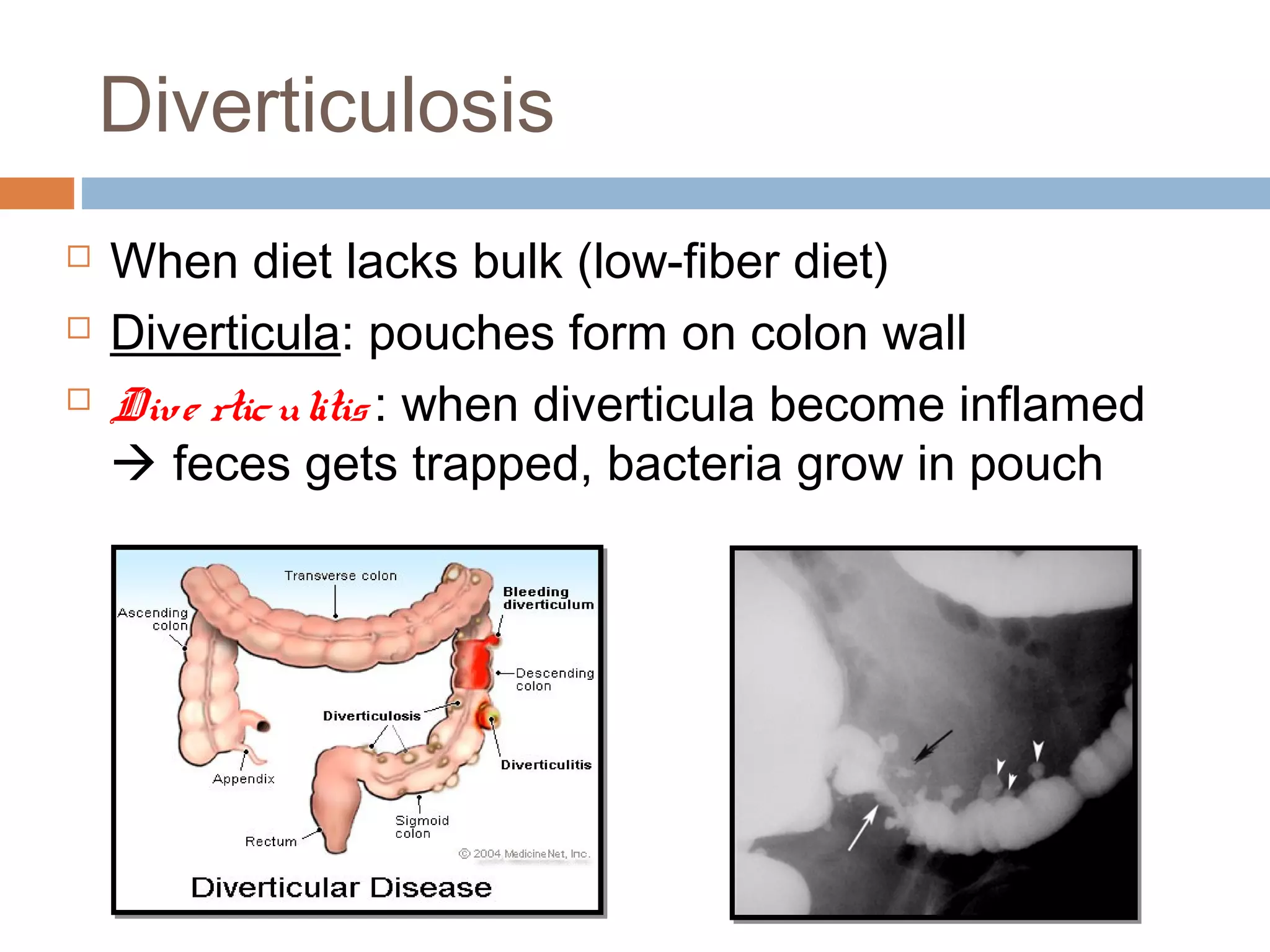 Trapped Germs Anatomy & Physiology Lecture Notes - Digestive system | PPT