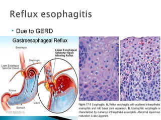 Pathology of the digestive system | PPT