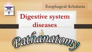 Digestive system
diseases
Esophageal Achalasia
 