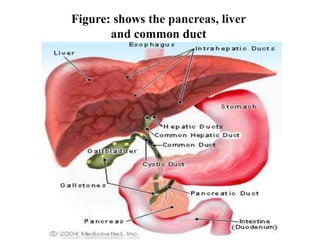 Figure: shows the pancreas, liver
and common duct
 