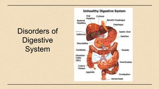 Disorders of
Digestive
System
 