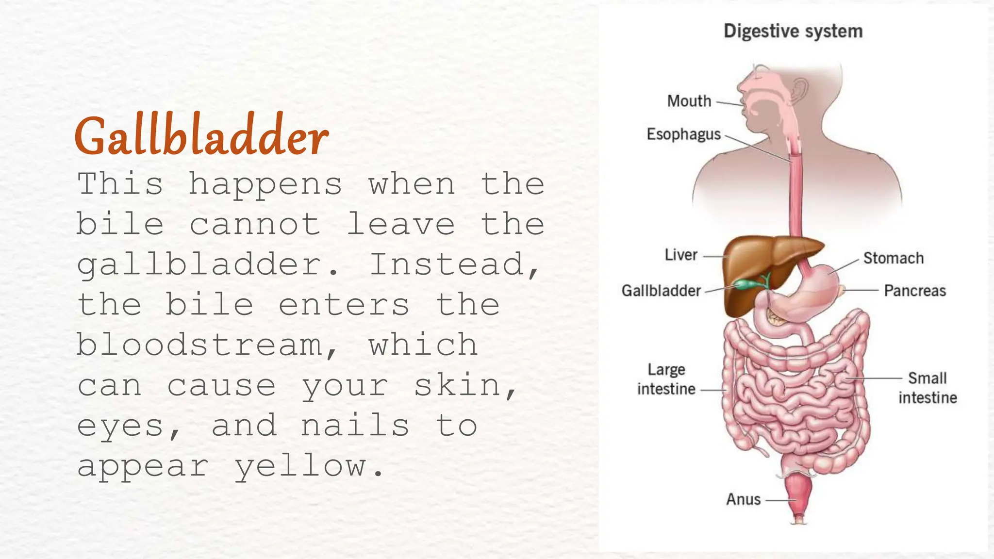 This happens when the
bile cannot leave the
gallbladder. Instead,
the bile enters the
bloodstream, which
can cause your skin,
eyes, and nails to
appear yellow.
Gallbladder
 