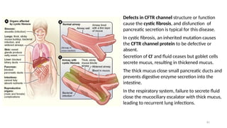 81
Defects in CFTR channel structure or function
cause the cystic fibrosis, and disfunction of
pancreatic secretion is typical for this disease.
In cystic fibrosis, an inherited mutation causes
the CFTR channel protein to be defective or
absent.
Secretion of Cl-
and fluid ceases but goblet cells
secrete mucus, resulting in thickened mucus.
The thick mucus close small pancreatic ducts and
prevents digestive enzyme secretion into the
intestine.
In the respiratory system, failure to secrete fluid
close the mucociliary escalator with thick mucus,
leading to recurrent lung infections.
 