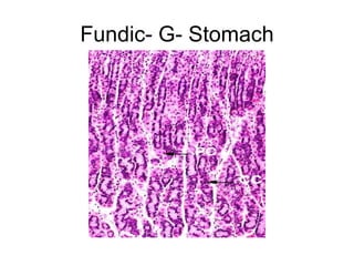 Fundic- G- Stomach