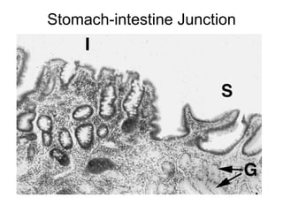 Stomach-intestine Junction