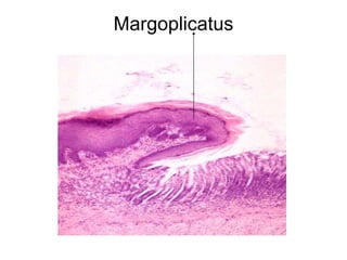 Margoplicatus