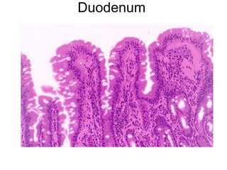 Duodenum