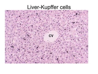 Liver-Kupffer cells