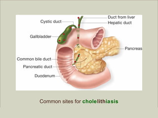 Common sites for cholelithiasis
                                                         Copyright ©2009 by Pearson Education, Inc.
Medical Terminology: A Living Language, Fourth Edition       Upper Saddle River, New Jersey 07458
Bonnie F. Fremgen and Suzanne S. Frucht                                          All rights reserved.
 