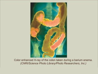 Color enhanced X-ray of the colon taken during a barium enema.
           (CNRI/Science Photo Library/Photo Researchers, Inc.)
                                                         Copyright ©2009 by Pearson Education, Inc.
Medical Terminology: A Living Language, Fourth Edition       Upper Saddle River, New Jersey 07458
Bonnie F. Fremgen and Suzanne S. Frucht                                          All rights reserved.
 