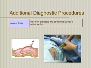 Additional Diagnostic Procedures
               insertion of needle into abdominal cavity to
paracentesis
               withdraw fluid
 