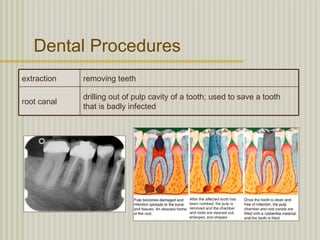 Dental Procedures
extraction   removing teeth

             drilling out of pulp cavity of a tooth; used to save a tooth
root canal
             that is badly infected
 