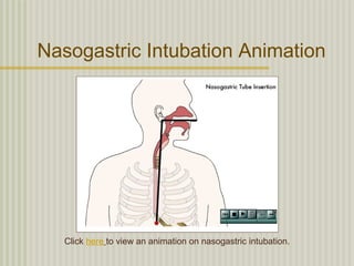 Nasogastric Intubation Animation




   Click here to view an animation on nasogastric intubation.
 