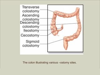 The colon illustrating various –ostomy sites.

                                                          Copyright ©2009 by Pearson Education, Inc.
Medical Terminology: A Living Language, Fourth Edition        Upper Saddle River, New Jersey 07458
Bonnie F. Fremgen and Suzanne S. Frucht                                           All rights reserved.
 