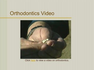 Orthodontics Video




      Click here to view a video on orthodontics.
 