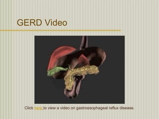 GERD Video




 Click here to view a video on gastroesophageal reflux disease.
 