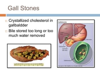 The Anatomy &amp; Physiology of the Digestive System .pptx