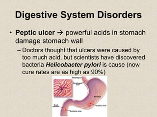 Digestive System Disorders
• Peptic ulcer  powerful acids in stomach
damage stomach wall
– Doctors thought that ulcers were caused by
too much acid, but scientists have discovered
bacteria Helicobacter pylori is cause (now
cure rates are as high as 90%)
 