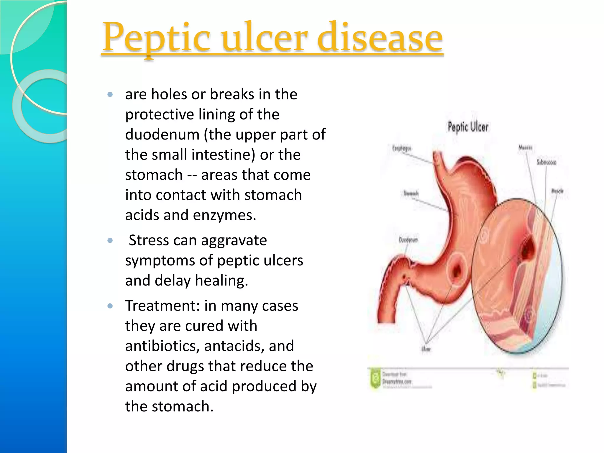 Peptic ulcer disease
 are holes or breaks in the
protective lining of the
duodenum (the upper part of
the small intestine) or the
stomach -- areas that come
into contact with stomach
acids and enzymes.
 Stress can aggravate
symptoms of peptic ulcers
and delay healing.
 Treatment: in many cases
they are cured with
antibiotics, antacids, and
other drugs that reduce the
amount of acid produced by
the stomach.
 