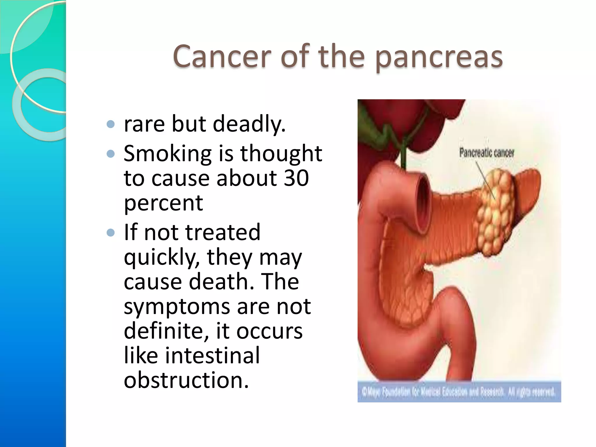 Cancer of the pancreas
 rare but deadly.
 Smoking is thought
to cause about 30
percent
 If not treated
quickly, they may
cause death. The
symptoms are not
definite, it occurs
like intestinal
obstruction.
 