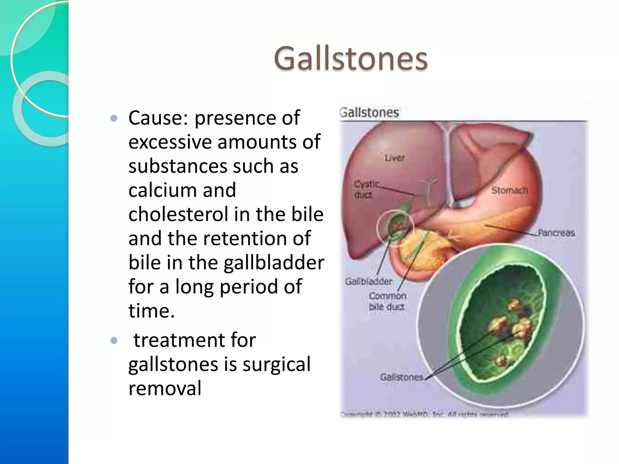 Gallstones
 Cause: presence of
excessive amounts of
substances such as
calcium and
cholesterol in the bile
and the retention of
bile in the gallbladder
for a long period of
time.
 treatment for
gallstones is surgical
removal
 