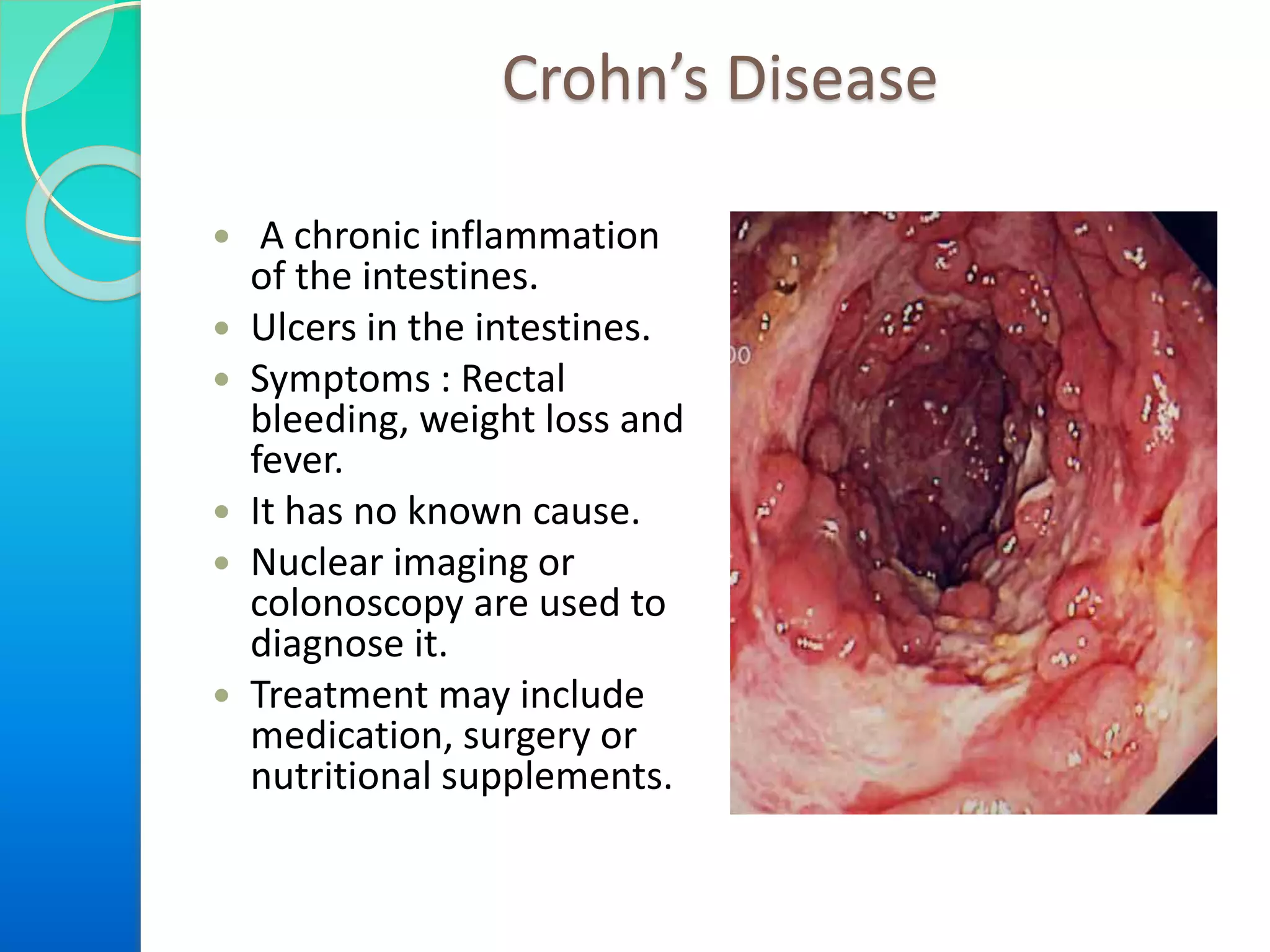 Crohn’s Disease
 A chronic inflammation
of the intestines.
 Ulcers in the intestines.
 Symptoms : Rectal
bleeding, weight loss and
fever.
 It has no known cause.
 Nuclear imaging or
colonoscopy are used to
diagnose it.
 Treatment may include
medication, surgery or
nutritional supplements.

 