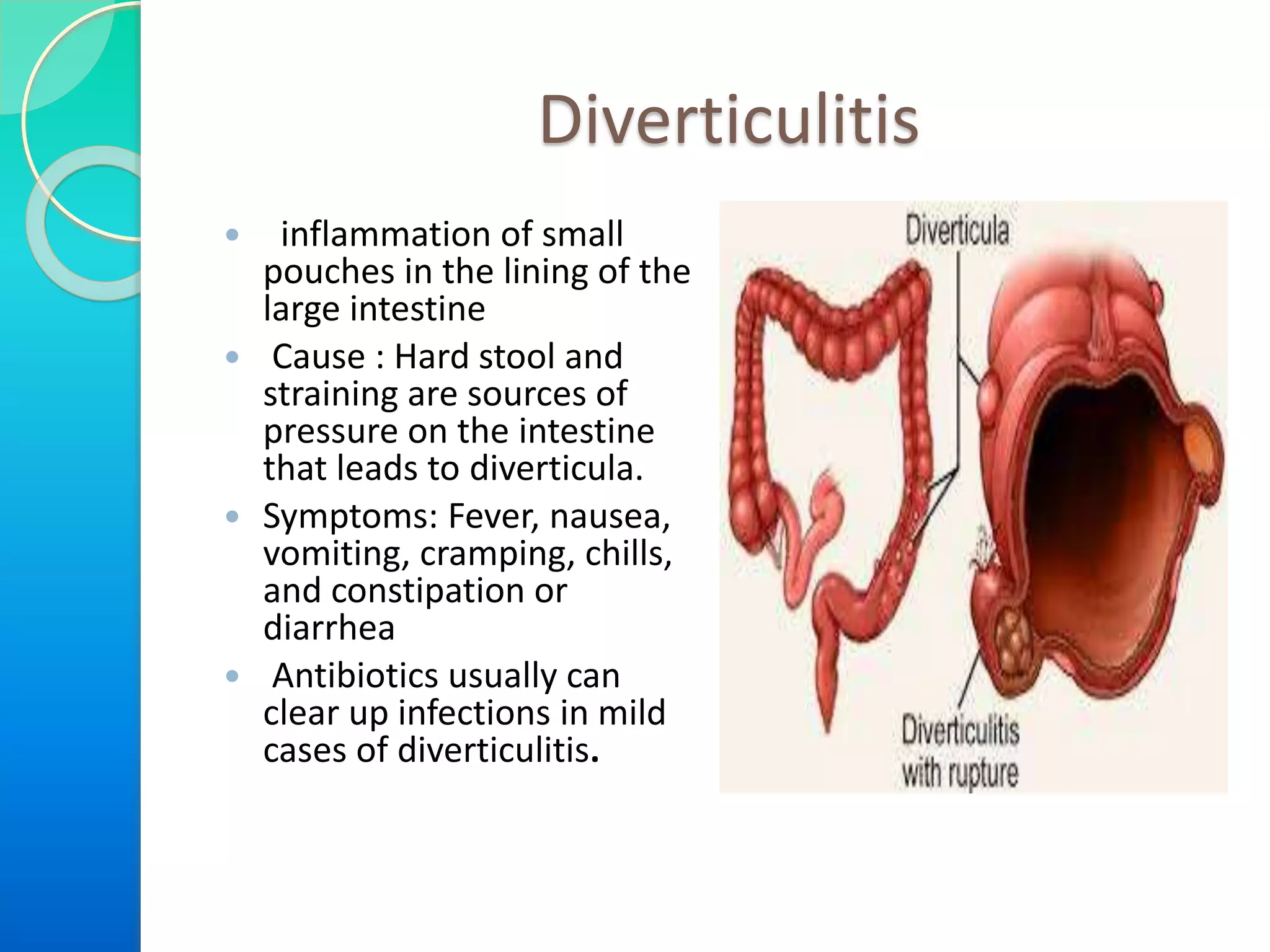 Diverticulitis
 inflammation of small
pouches in the lining of the
large intestine
 Cause : Hard stool and
straining are sources of
pressure on the intestine
that leads to diverticula.
 Symptoms: Fever, nausea,
vomiting, cramping, chills,
and constipation or
diarrhea
 Antibiotics usually can
clear up infections in mild
cases of diverticulitis.

 