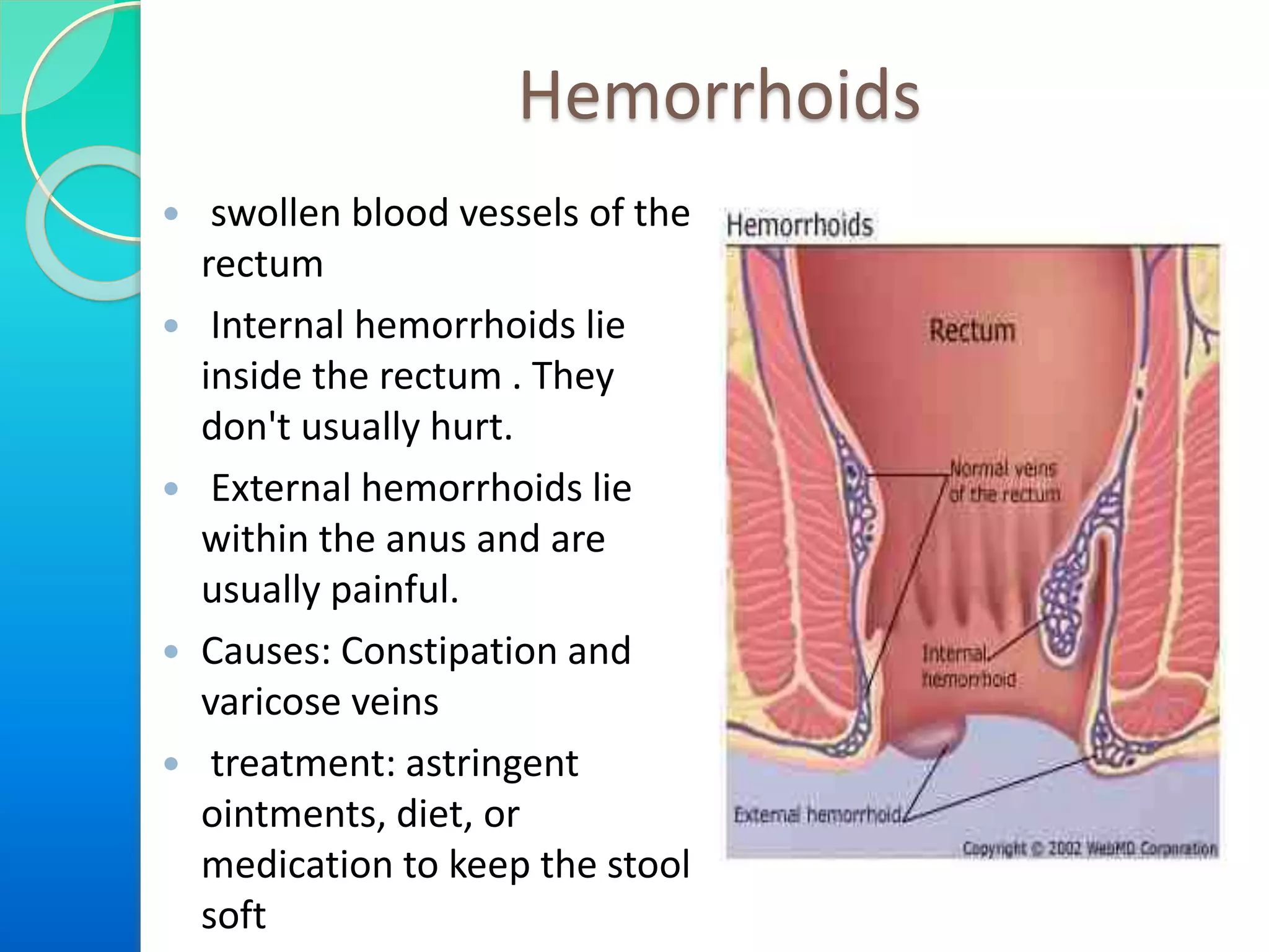 Hemorrhoids
 swollen blood vessels of the
rectum
 Internal hemorrhoids lie
inside the rectum . They
don't usually hurt.
 External hemorrhoids lie
within the anus and are
usually painful.
 Causes: Constipation and
varicose veins
 treatment: astringent
ointments, diet, or
medication to keep the stool
soft
 