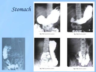 Digestive system imaging 1 class | PPTX